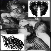 Carcinomas Of Unknown Primary Origin / Feeding Jejunostomy After Upper Elective Gastrointestinal Surgery