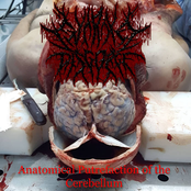 Anatomical Putrefaction of the Cerebellum
