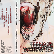 Teenage Werewolf