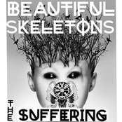 Beautiful Skeletons: The Suffering
