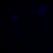 airing dirty laundry