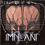 Brainstorm by Implant