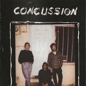 Concussion