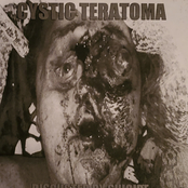 Disgusted By Suicide