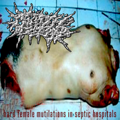 Hard Female Mutilations In Septic Hospitals