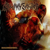 Liquidate Vaginal by Sanguinary Execution