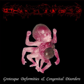 Grotesque Deformities & Congenital Disorders