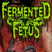 fermented fetus