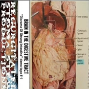 Diorama Of Stung Intestine
