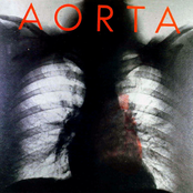 Heart Attack by Aorta