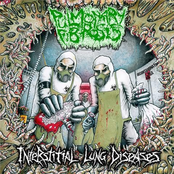 Consumed Gnawing Entrails by Pulmonary Fibrosis