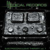 Electroconvulsive Therapy Vol. 1