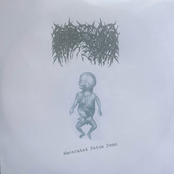 Macerated Fetus Demo