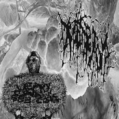 Urinary Tract Infection From Severe Pus Clots / Dermatofibrosarcoma – Split