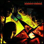 arrhythmia