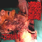 Postmortem Neurofetish Bionecrosis / Infester