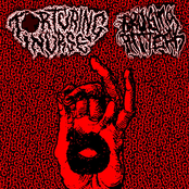 Torturing Nurse / Bruising Pattern