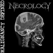 Carbonized by Necrology