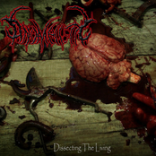 Dissecting The Living