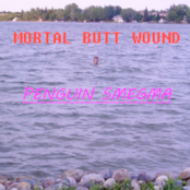 mortal butt wound