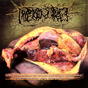 The Prevention Of Wound Infection Following Contamination With Colon Organism