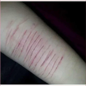 MUSSIKKAS" PARA SIH KKORTAR #slaxxergang