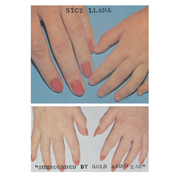 Surrounded By Gold and Dead