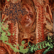 Splattered Phlegm / Hemorrhoidal Milk Enema