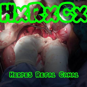 herpes retal canal