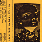 The Crazy Side Of IRRE-Tapes