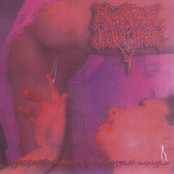 Infected Fragments of Menstrual Sangria