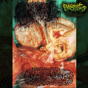 Gangrenous Erythromelalgia / Ovoviviparity  Split Tape