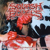 For Dead God - International Devastation