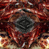 Diphyllobothriasis (2021)