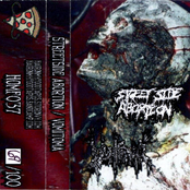 Street Side Abortion / Vomitoma