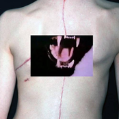 Breathing Problem - Reactive Attachment Disorder