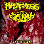 Split Tape