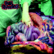 Morbida Exposicion Terminal