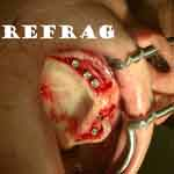 Some Plastic Product