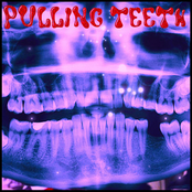 Pulling Teeth