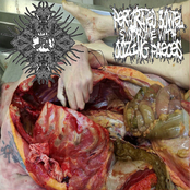 Leucodistrofia, Perforated Bowel Syndrome With Oozing Faeces – SPLIT