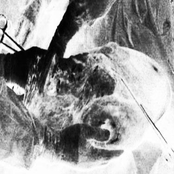 Flutter Tumor