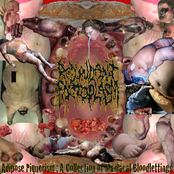 Intravenous Leptosporosis