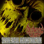 Severe Facial Reconstruction