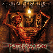 neural dysorder