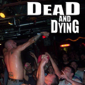 dead and dying