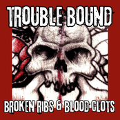 Broken Ribs & Blood Clots