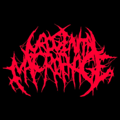 Pathological Slamming Early Demo 2009
