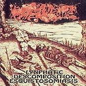 Lynphatic Descomposition Esquistosomiasis