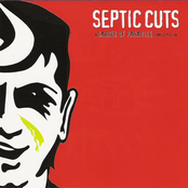 Septic Cuts